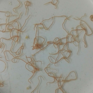 Genomics Lite: Parasitic Worms